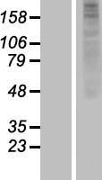 ls026740 or1j2 human over expression lysates nm 054107 wb testing 1