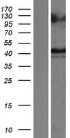 TIM 1 (HAVCR1) Human Over-expression Lysates NM_012206