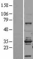 STEAP1 Human Over-expression Lysates NM_012449