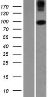COPG2 Human Over-expression Lysates NM_012133
