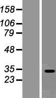 SEC22L2 (SEC22A) Human Over-expression Lysates NM_012430