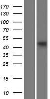 ls026985 ap3m1 human over expression lysates nm 012095 wb testing 2