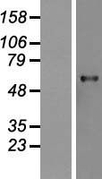 USP21 Human Over-expression Lysates NM_001014443