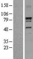 Dynein intermediate chain 1 (DNAI1) Human Over-expression Lysates NM_012144