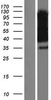 NPTN Human Over-expression Lysates NM_001161364