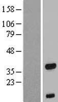 FOXB1 Human Over-expression Lysates NM_012182
