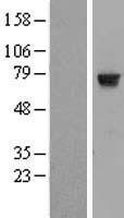 HTF9C (TRMT2A) Human Over-expression Lysates NM_022727