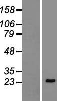 LAT Human Over-expression Lysates NM_001014987