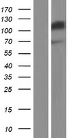 SND1 Human Over-expression Lysates NM_014390