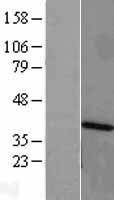 ls027063 ankrd1 human over expression lysates nm 014391 wb testing 1