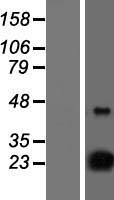 D4S234E (NSG1) Human Over-expression Lysates NM_001040101