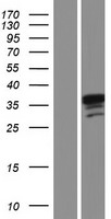 PPA2 Human Over-expression Lysates NM_001034191