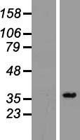 PPA2 Human Over-expression Lysates NM_006903