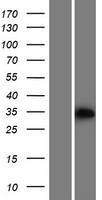 PPA2 Human Over-expression Lysates NM_176869