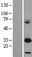 DAPP1 Human Over-expression Lysates NM_014395