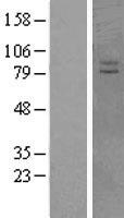 VPS41 Human Over-expression Lysates NM_080631