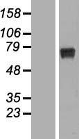 RPUSD2 Human Over-expression Lysates NM_152260