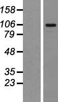 ls027085 mtbp human over expression lysates nm 022045 wb testing 1