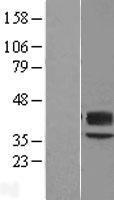 CD57 (B3GAT1) Human Over-expression Lysates NM_054025