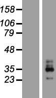 ls027094 kcnmb3 human over expression lysates nm 014407 wb testing 4