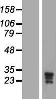 ls027094 kcnmb3 human over expression lysates nm 171828 wb testing 1