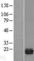TRAPPC3 Human Over-expression Lysates NM_014408