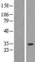 SND1-IT1 Human Over-expression Lysates NM_014411
