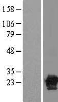 SIAH Interacting Protein (CACYBP) Human Over-expression Lysates NM_014412