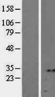 Syntenin 2 (SDCBP2) Human Over-expression Lysates NM_015685