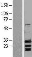 Bcl2 Binding component 3 (BBC3) Human Over-expression Lysates NM_014417