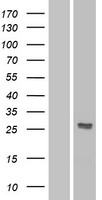 DKK2 Human Over-expression Lysates NM_014421