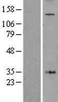 AFF4 Human Over-expression Lysates NM_014423