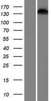 SMC1L2 (SMC1B) Human Over-expression Lysates NM_148674