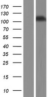 Inversin (INVS) Human Over-expression Lysates NM_014425