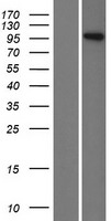 Inversin (INVS) Human Over-expression Lysates NM_183245