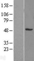 SNX5 Human Over-expression Lysates NM_014426