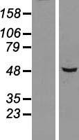 SNX5 Human Over-expression Lysates NM_152227