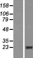 CIDE B (CIDEB) Human Over-expression Lysates NM_014430
