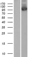 PALD (PALD1) Human Over-expression Lysates NM_014431