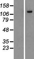 ls027147 dennd2a human over expression lysates nm 015689 wb testing 1