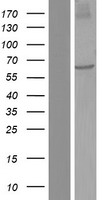 NDOR1 Human Over-expression Lysates NM_001144026
