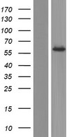 NDOR1 Human Over-expression Lysates NM_001144027
