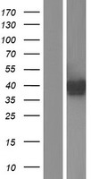 ASAHL (NAAA) Human Over-expression Lysates NM_001042402