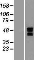 ASAHL (NAAA) Human Over-expression Lysates NM_014435