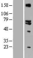 GLS2 Human Over-expression Lysates NM_013267