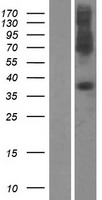 SLC39A1 Human Over-expression Lysates NM_014437