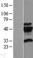 gamma Tubulin (TUBG2) Human Over-expression Lysates NM_016437