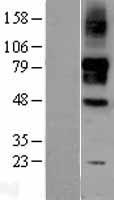 SIGLEC9 Human Over-expression Lysates NM_014441