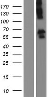 ls027185 disc1 human over expression lysates nm 001164548 wb testing 2