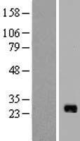 IL17B Human Over-expression Lysates NM_014443